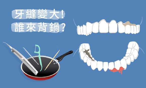 牙縫變大誰的鍋？關於口腔謠言這回事…
